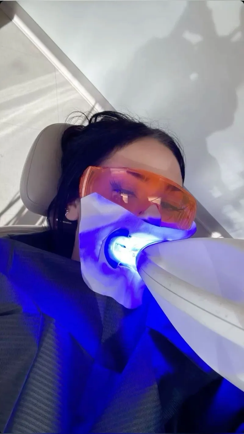 BLANCHIMENT DENTAIRE 1 SÉANCE 🦷